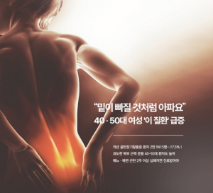 [여성&문화] “밑이 빠질 것처럼 아파요” 40 · 50대 여성 '이 질환' 급증